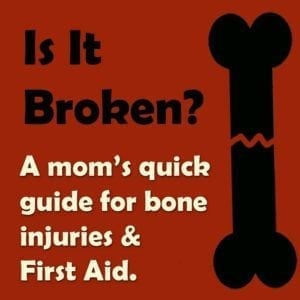 Broken bones | x-ray | healing | legs | arms | how to tell