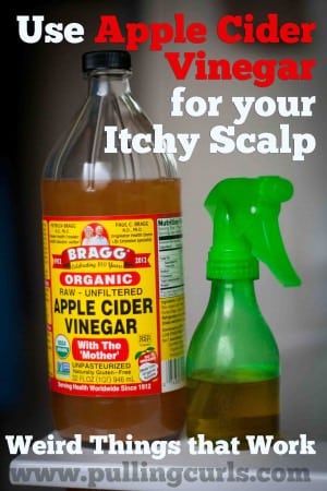 Itchy scalp remedy - Use apple cider vinegar for an itchy scalp treatment and find out itchy scalp causes