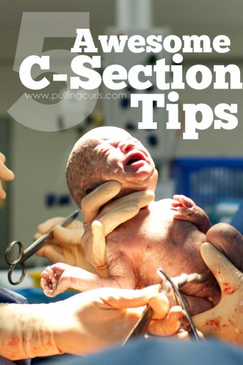 C-Section | Cesarean Section | Recovery | Mom | Scar | facts | tips | operating room | hospital | repeat | VBAC | TOLAC | emergency