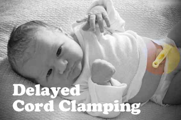 Delayed cord clamping answers / benefits of / risks / iron deficiency / health / newborn /c-section