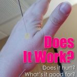 acupuncture for fertility