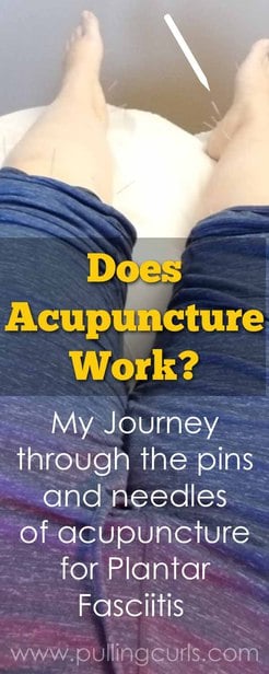 Does acupuncture REALLY work?  Hurt / benefits/ weight loss / works / fertility #acupuncture #weightloss #health via @pullingcurls