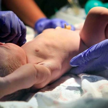 newborn baby after birth