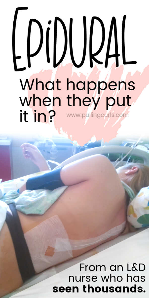 what happens when they put the epidural in? via @pullingcurls