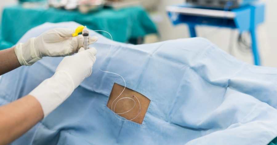 Does An Epidural For Labor Completely Take Away The Pain 