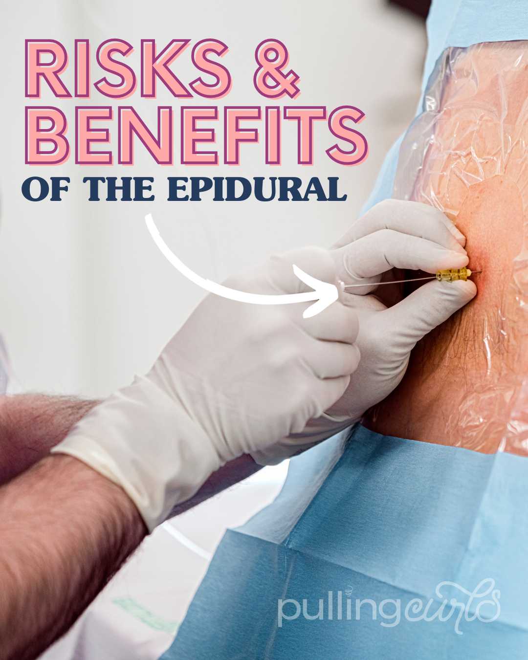 what happens when they put the epidural in? via @pullingcurls