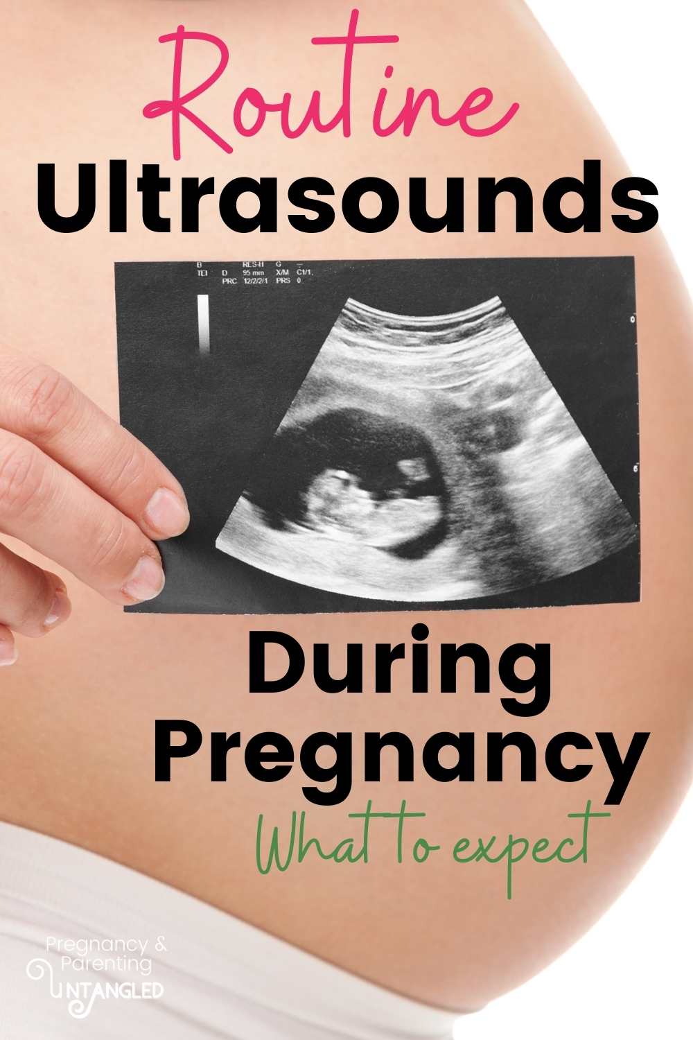There are a few routine ultrasounds that are indicated during pregnancy. They give us important facts about our pregnancy, and today we have a maternal fetal medicine stenographer who's going to tell us what they're for, and what to expect! via @pullingcurls