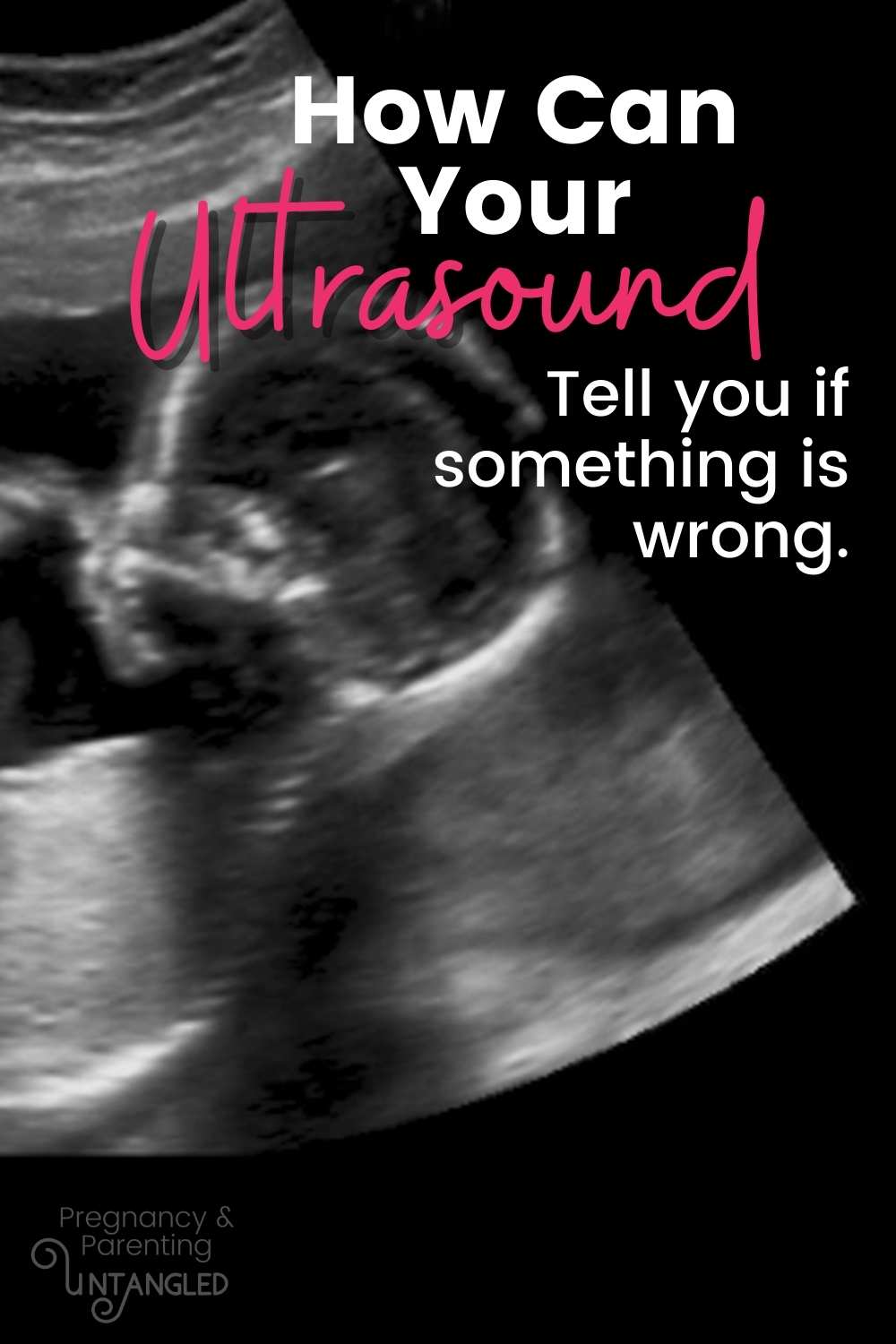 While there are routine ultrasounds that almost every pregnant person gets. There are specific ultrasound that are ordered if there is an issue seen. Today we're going to go through those issues and what they might be interested in. via @pullingcurls