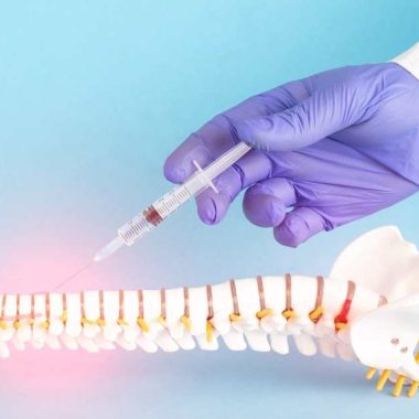 epidural placement