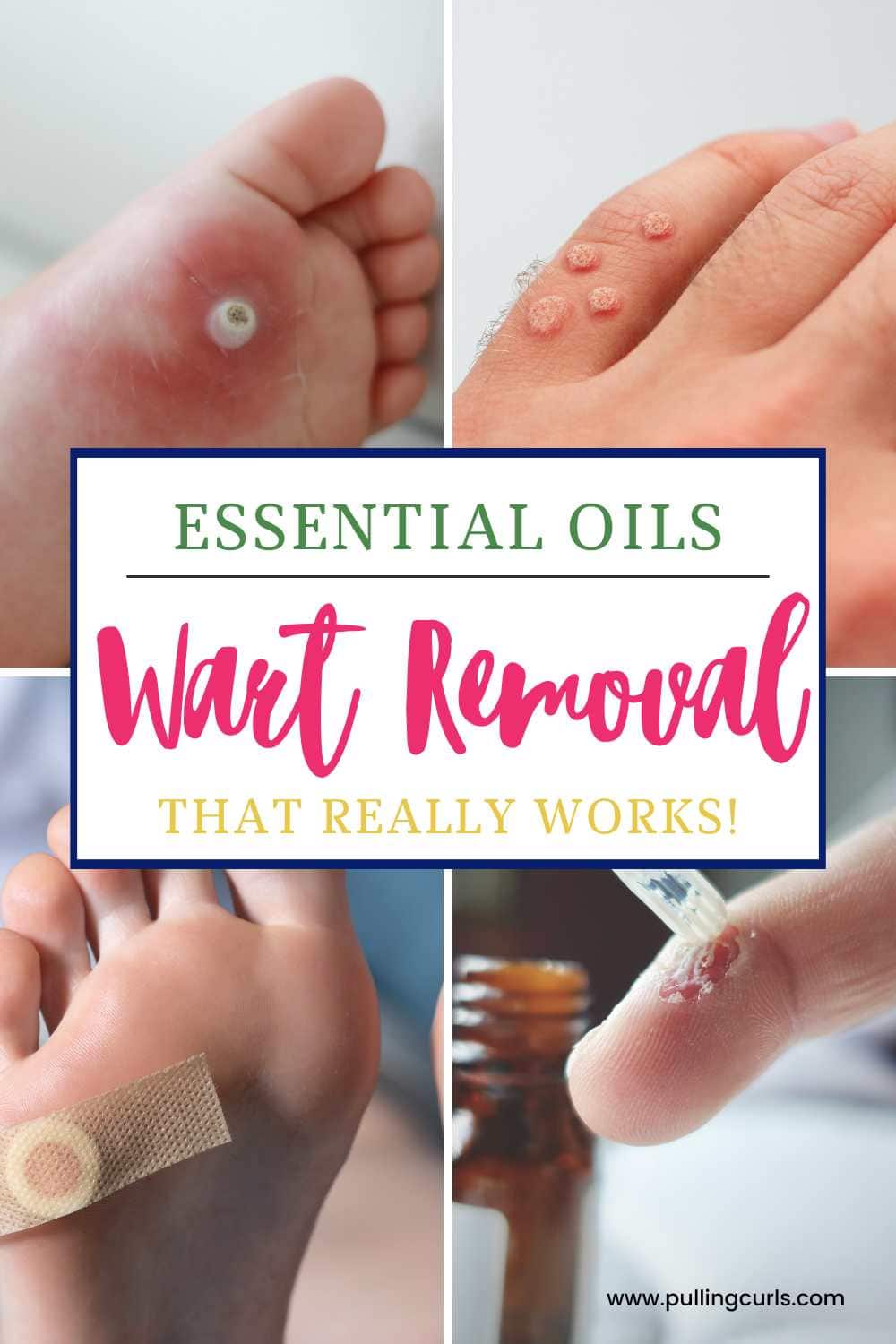 Discover the power of essential oils for wart removal! Using tea tree, oregano, apple cider vinegar and more, we can create a DIY home remedy to banish those unsightly warts. Don't let warts bother you any longer, try this natural remedy today! via @pullingcurls