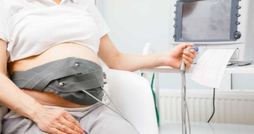 fetal heart rate and contraction monitor on pregnant woman