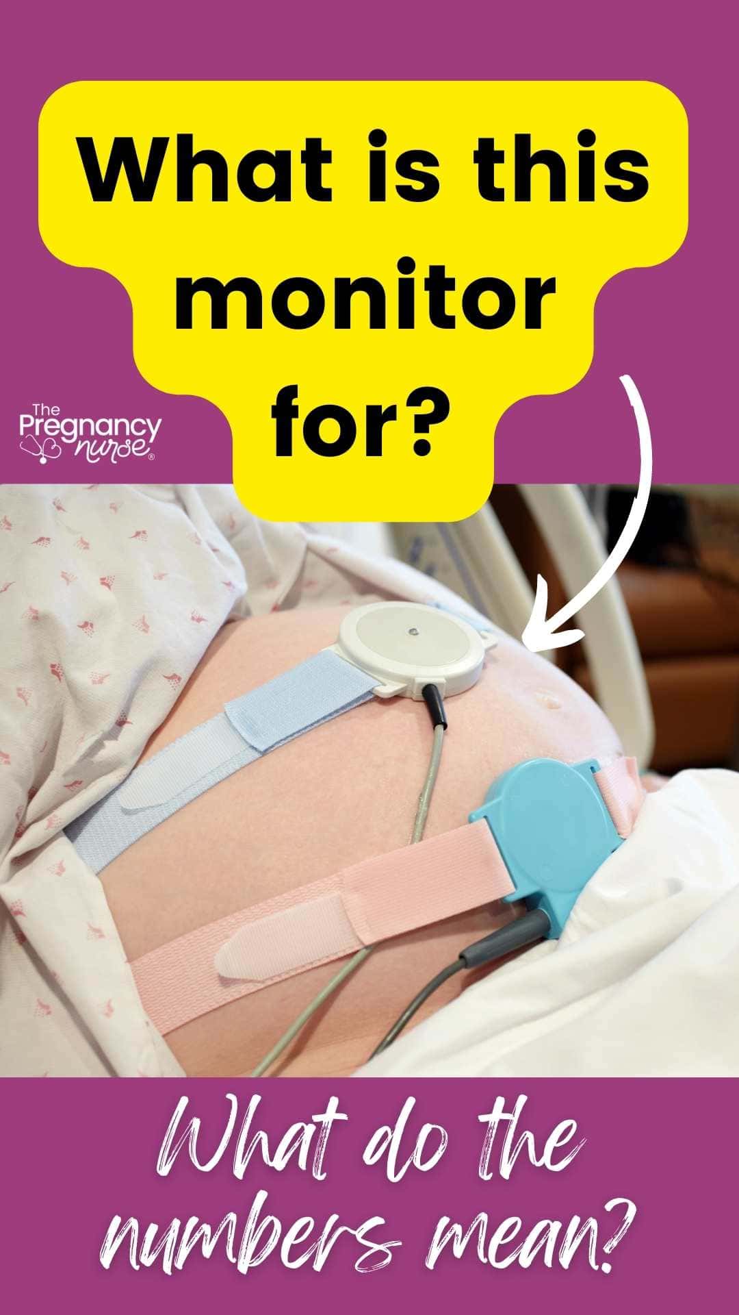 How to Read a Fetal Monitor During Labor