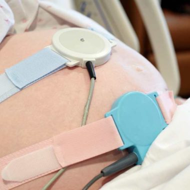 woman with fetal monitors on