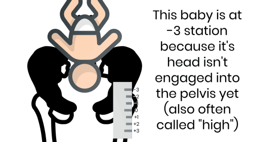 this is -3 station because baby's head isn't engaged into the pelvis yet (often called high) -- baby and pelvis image